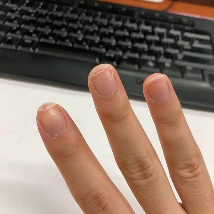 네일샵 기본 케어 받으면 손톱 상태 좀 괜찮아져???ㅠ_ㅠ - 인스티즈(instiz) 일상 카테고리