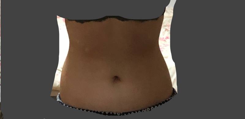 나 통허리 많이 심해.....? 혹시모를 ㅎㅂㅈㅇ... | 인스티즈