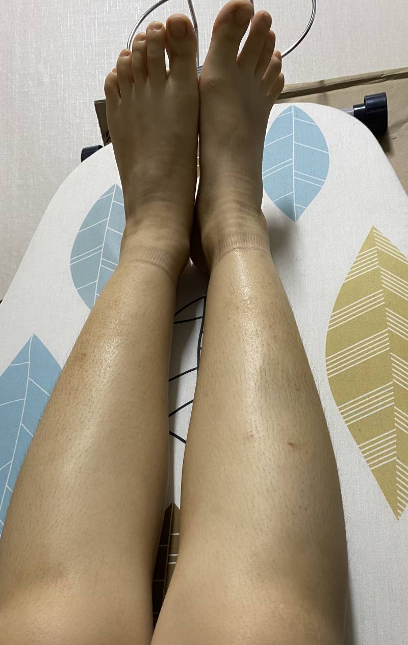 다리부은거봐 | 인스티즈