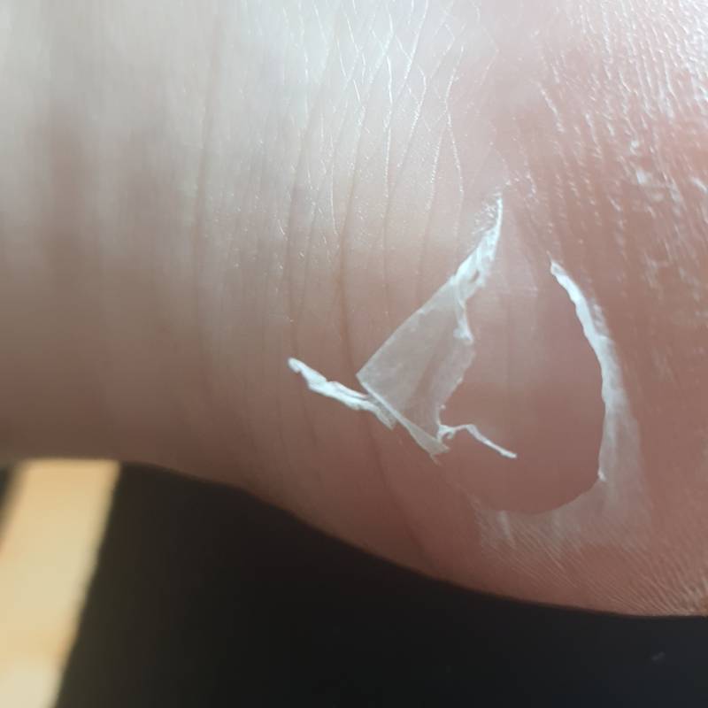 와 나는 발 각질팩 안 믿었거든 대박이야 (혐오주의) | 인스티즈