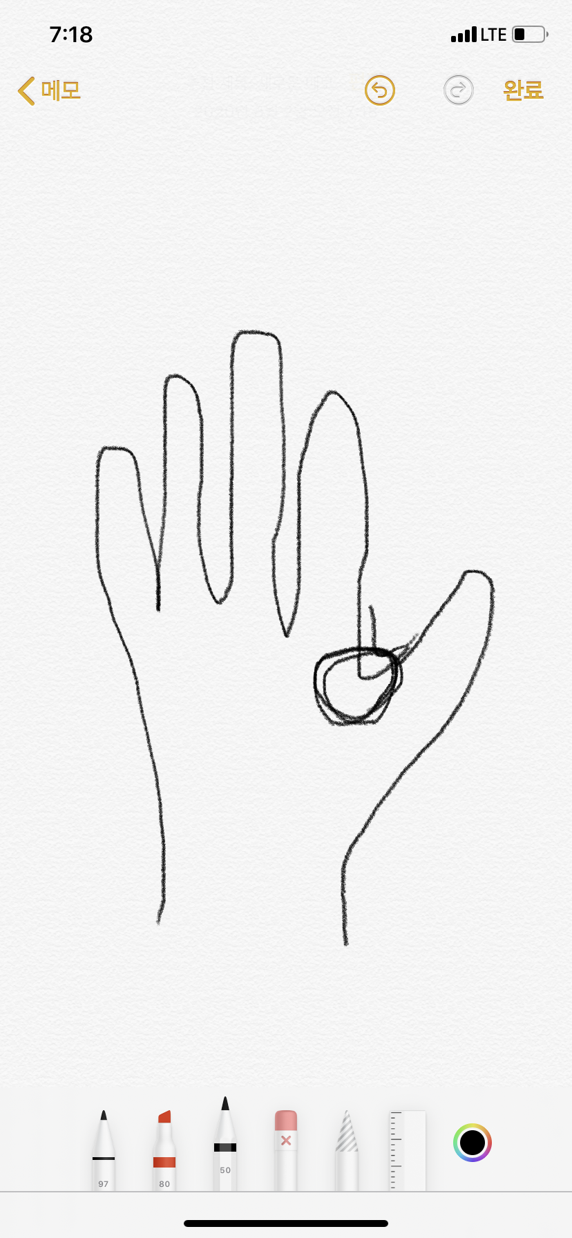 엄지랑 검지 사이가 되게 땡기고 아픈데 왜 그럴까 | 인스티즈