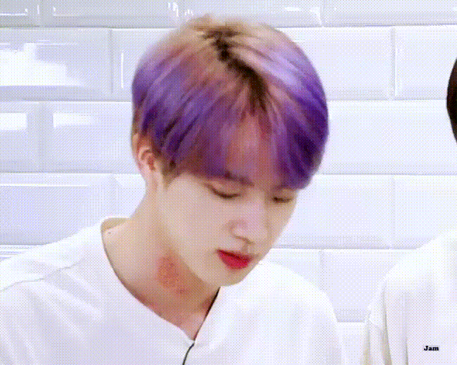 석진이 알러지 반응왔나부다 ㅠㅠㅠ | 인스티즈