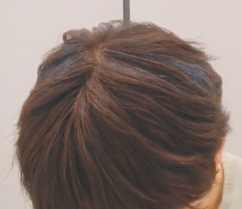 아니 제왑 이 정도면 머리 가릴 생각 없는 거 아니냐고 | 인스티즈