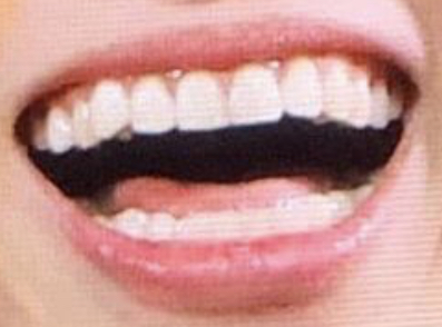 내 최애 치아 깎은것같아? | 인스티즈