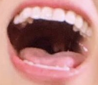 내 최애 치아 깎은것같아? | 인스티즈