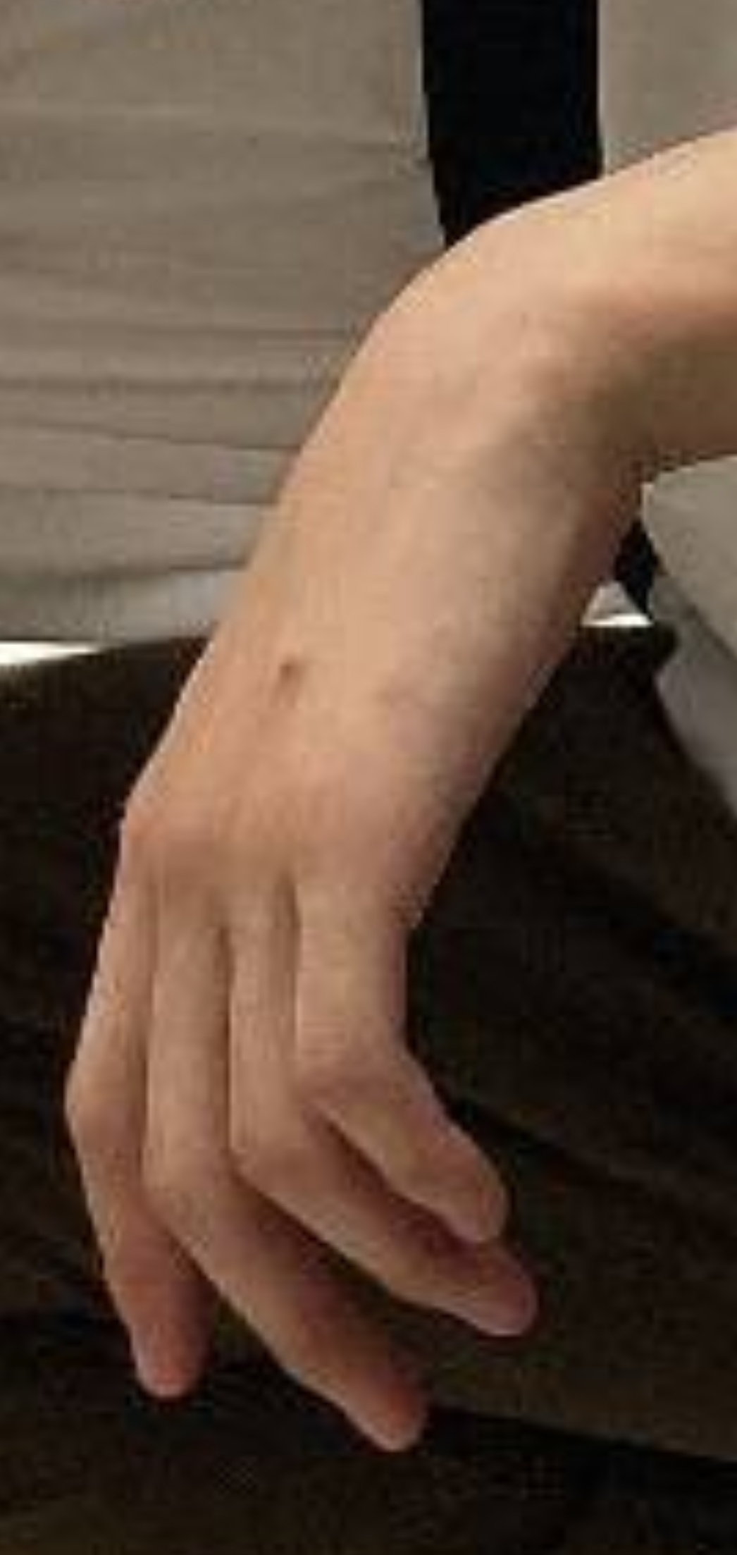 트레저 재혁이 아직도 손에 데인 자국 남아있네..ㅠㅠㅠㅠ | 인스티즈