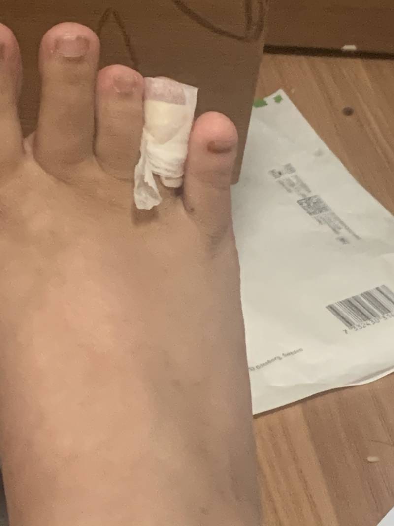 조직검사 하고 왔다 | 인스티즈