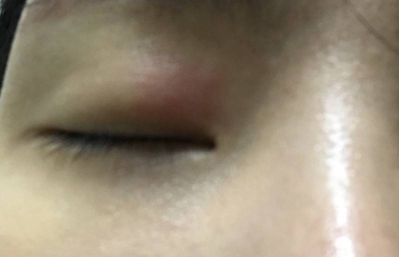 ......눈이 잘 안떠져..... 알바가야하는데... | 인스티즈