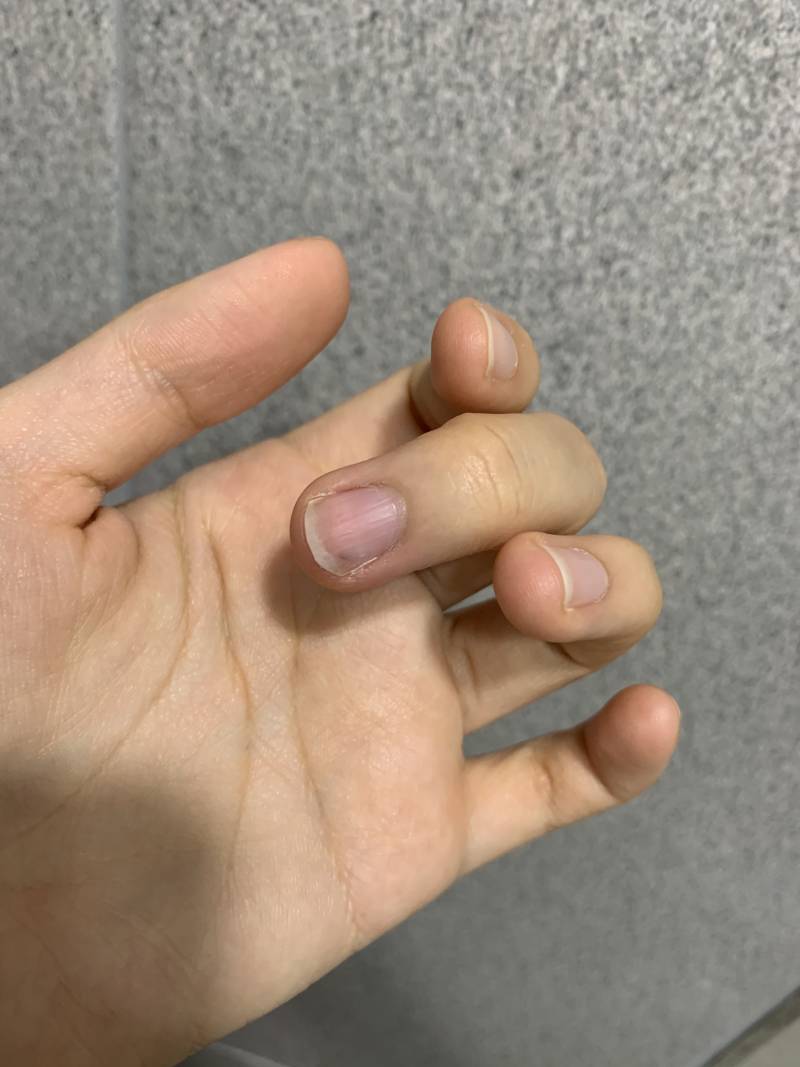 이거 손톱 멍 빼박이겠지? | 인스티즈