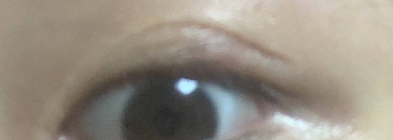 이거 다래끼같아...? | 인스티즈