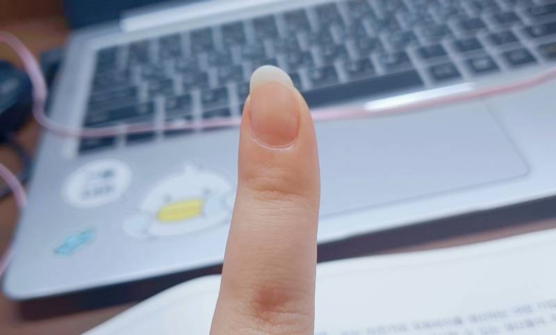 나 손톱이 이렇게 휘었는데 이것두 네일샵가면 다 잡아줘?! | 인스티즈