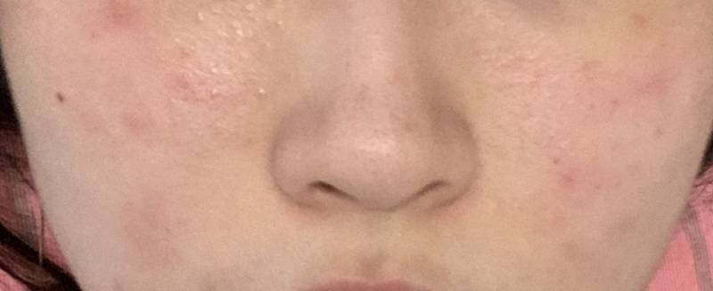 이런 피부 어떻게 해???? | 인스티즈