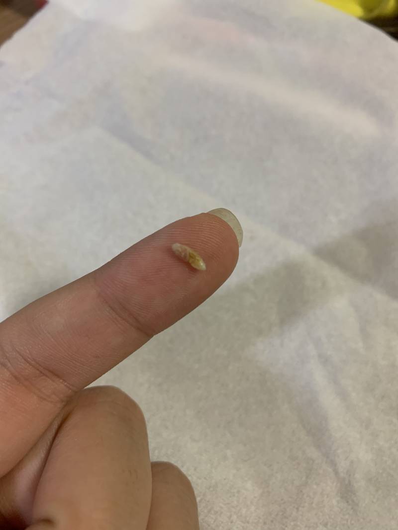 대왕 피지 나왔다 (ㅎㅇㅈㅇ) | 인스티즈