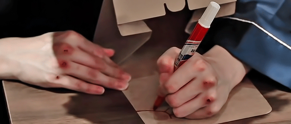 진짜 손 다 까진거 너무 마음이팠는데... | 인스티즈