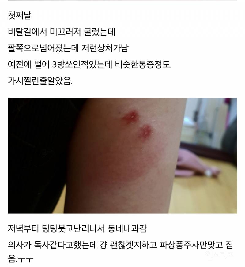 산책하다가 뱀에 물린 디씨인.jpg (혐오주의) | 인스티즈