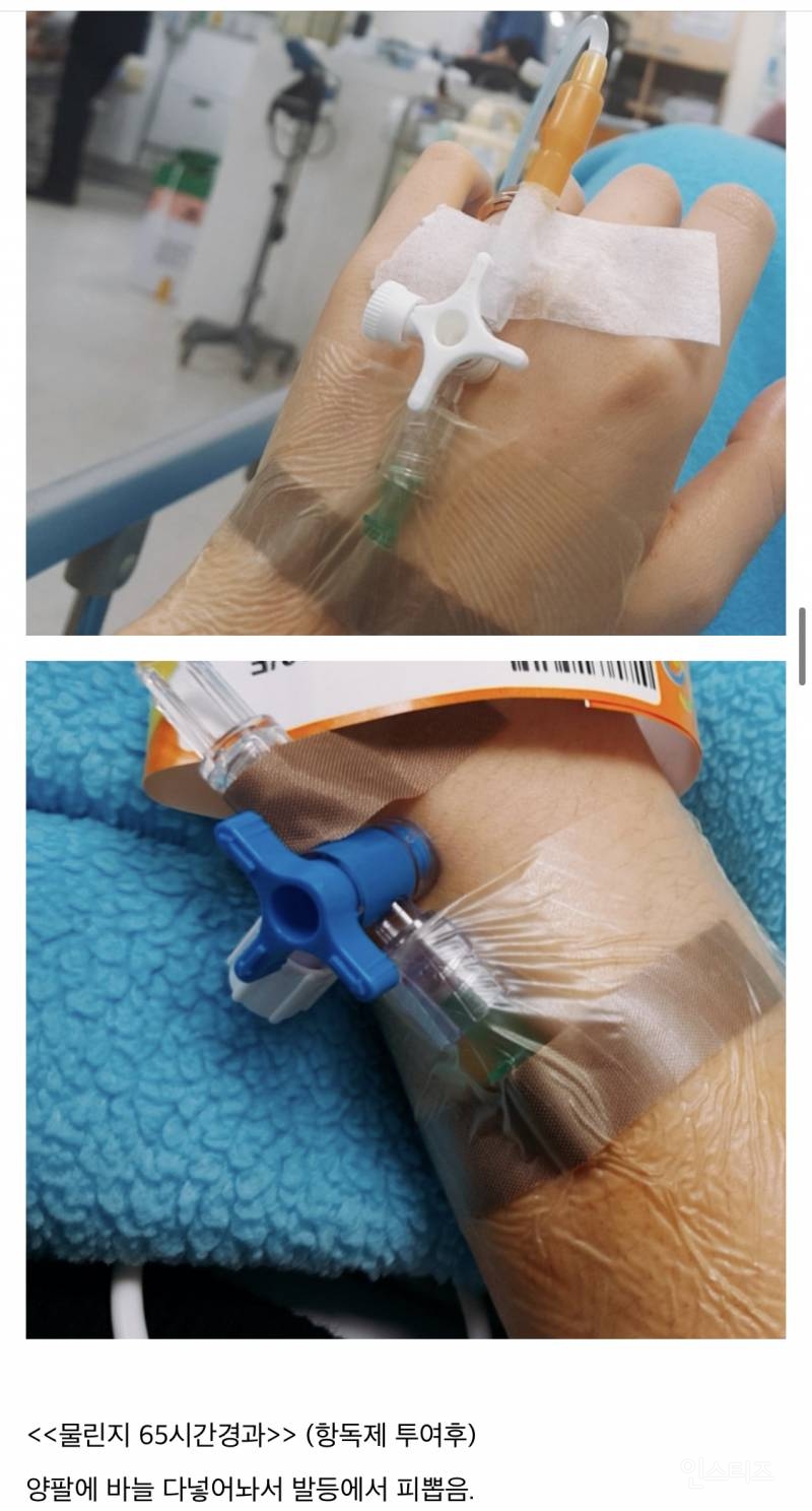 산책하다가 뱀에 물린 디씨인.jpg (혐오주의) | 인스티즈