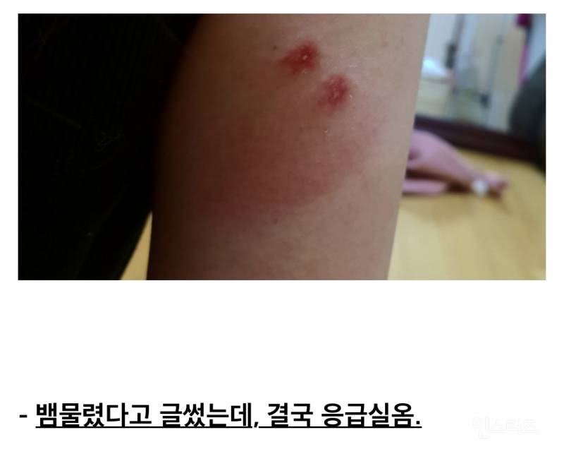 산책하다가 뱀에 물린 디씨인.jpg (혐오주의) | 인스티즈