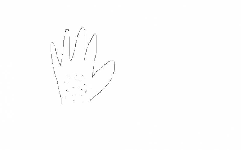 손에 두드러기 나본적있는사람,.. | 인스티즈