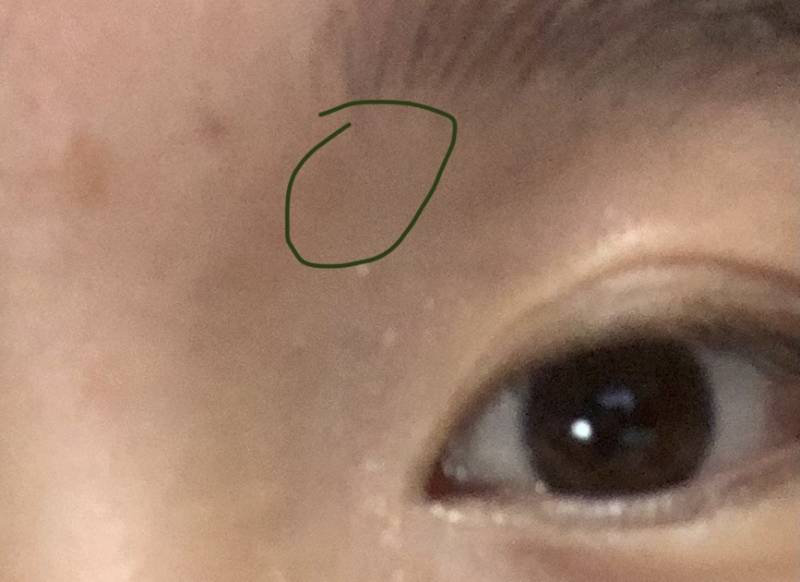 눈썹 밑 눈두덩이가 아픈데 왜 이러지 ㅜㅜ 이런적 있는 사람.. | 인스티즈