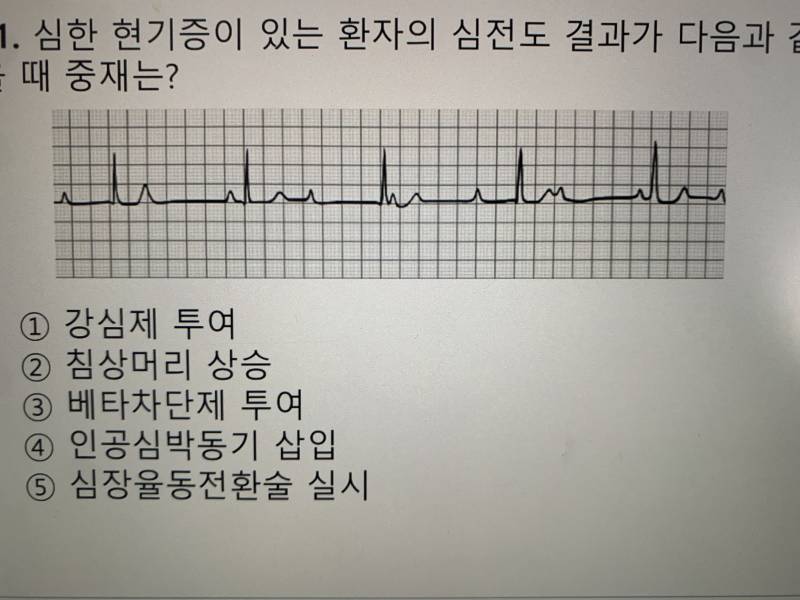 혹시 심전도 잘아는 익 있니 ㅠㅠㅠㅠ | 인스티즈