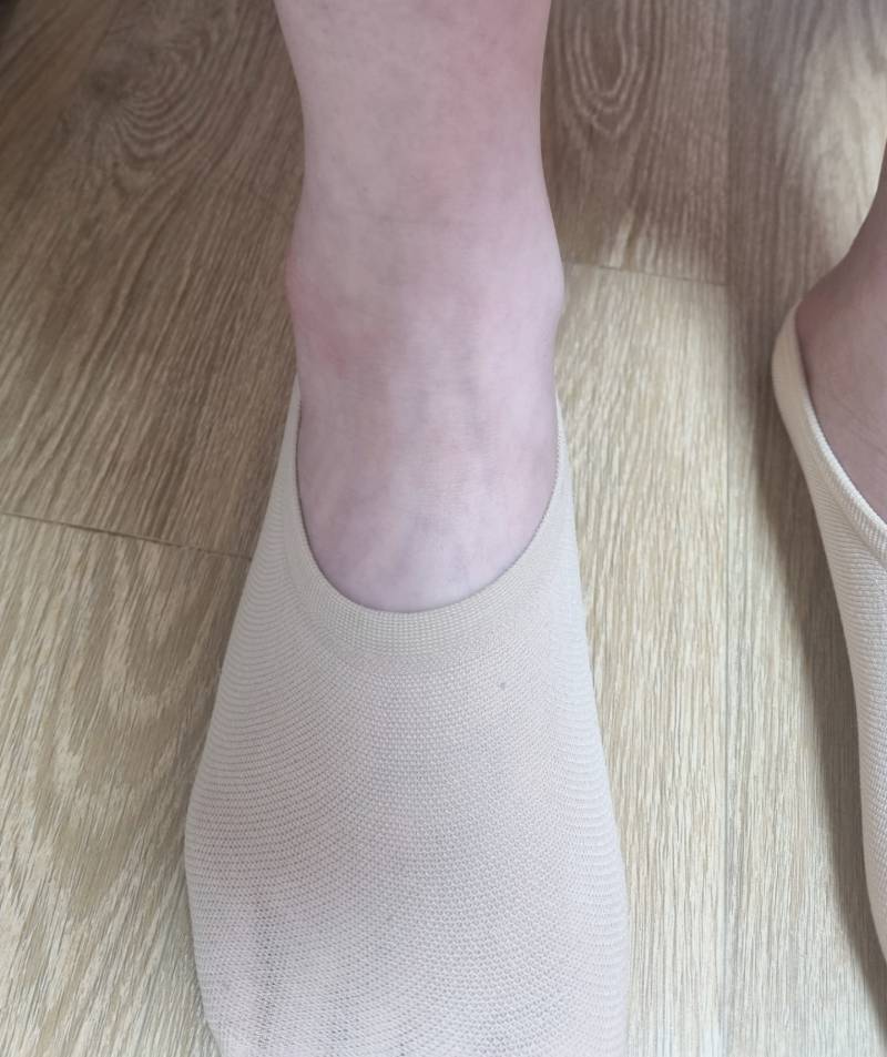 발목 삐끗했는데 이 정도는 병원 안 가도 되겠지? | 인스티즈