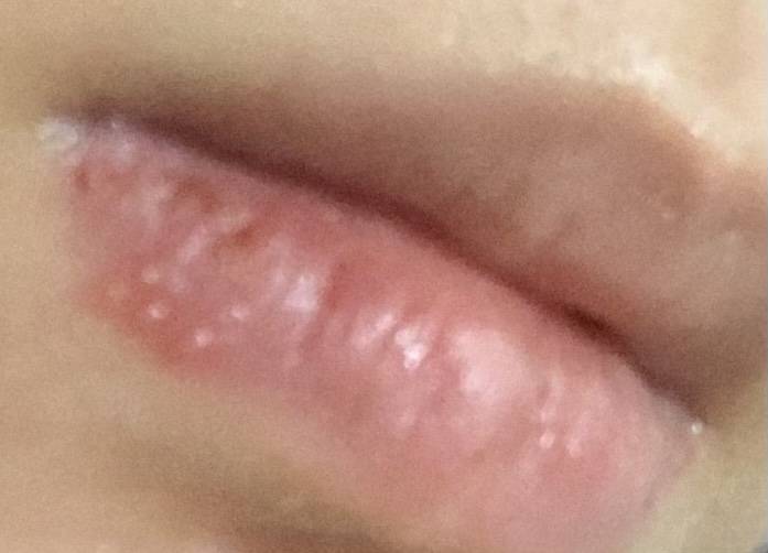 입술에 이런 거 나는데 뭐야..? | 인스티즈