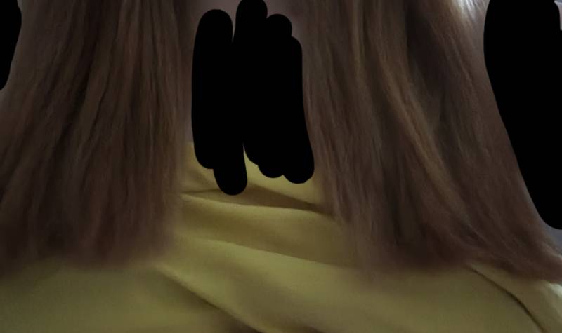 제발 이거 머리카락 왜 이러는지 아는사람❗❗❗❗❗ | 인스티즈