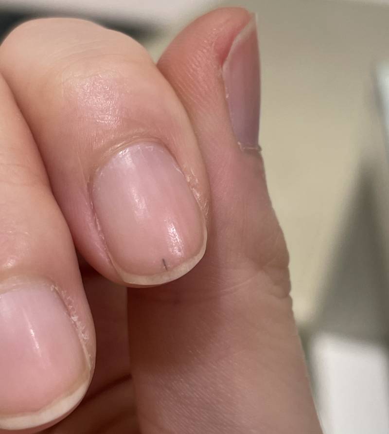 손톱에 이거 뭔지 알아...? (사진) | 인스티즈