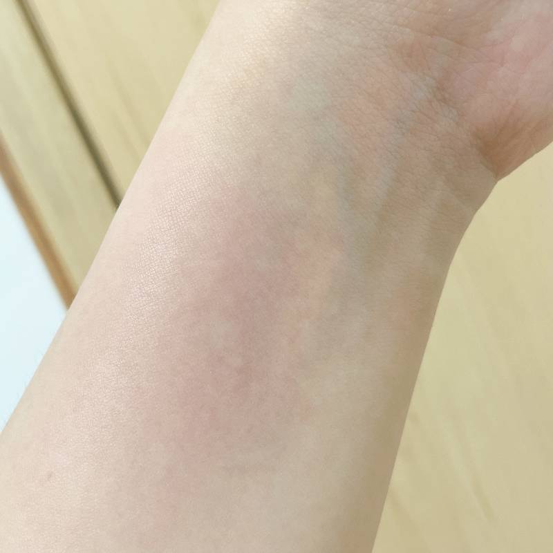 익들아 나 손목 왜이래.???? | 인스티즈