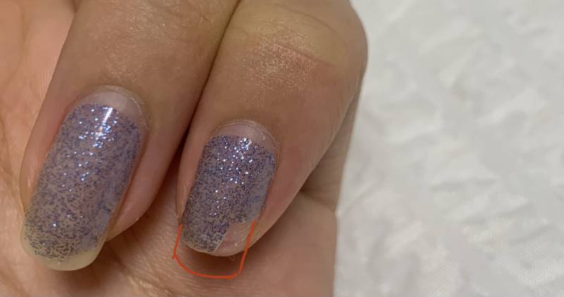 나 오늘 손톱 부러졌다.. | 인스티즈