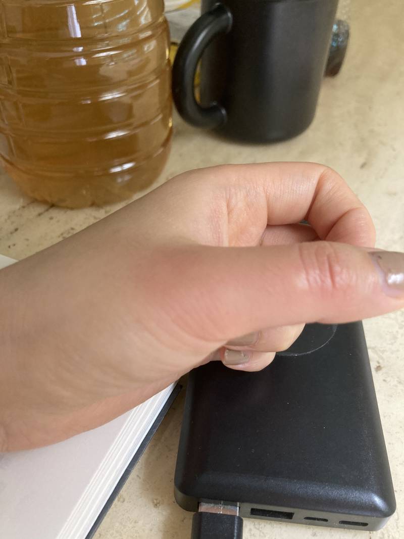 어제 벌레 물렸는데 오늘 또 갑자기 붓는다....왜이래 | 인스티즈