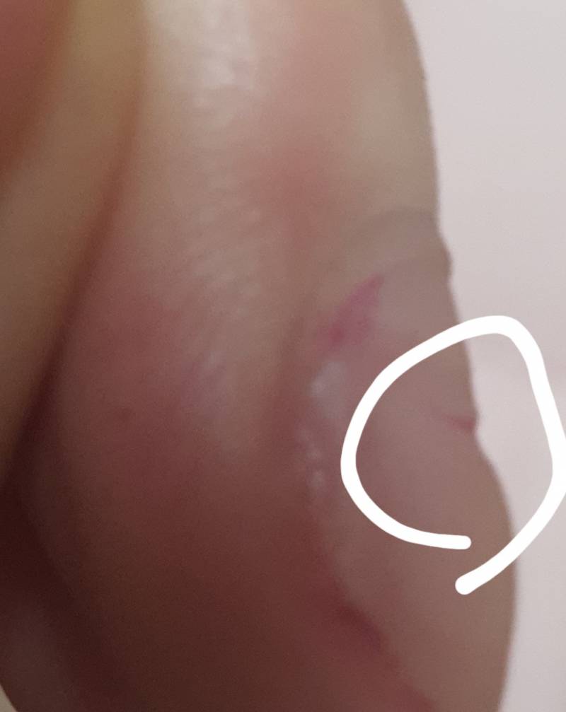 손톱이 이렇게 파진건 어떻게 해야할까?? | 인스티즈