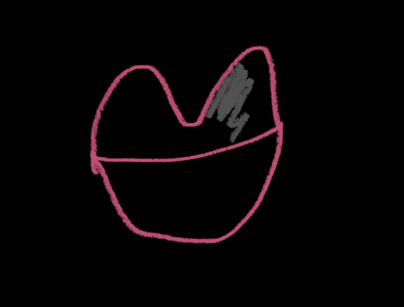 익들아 입술에 피멍이 들었는데 ㅋㅅ만으로도 이렇게 될 수 있어? | 인스티즈