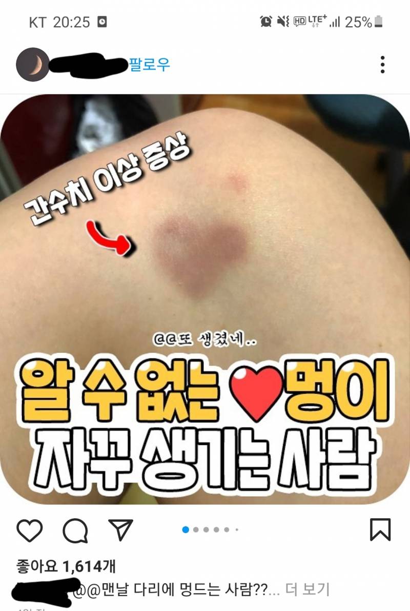 엥 인스타보는데 내 멍 사진 올라와있어 | 인스티즈