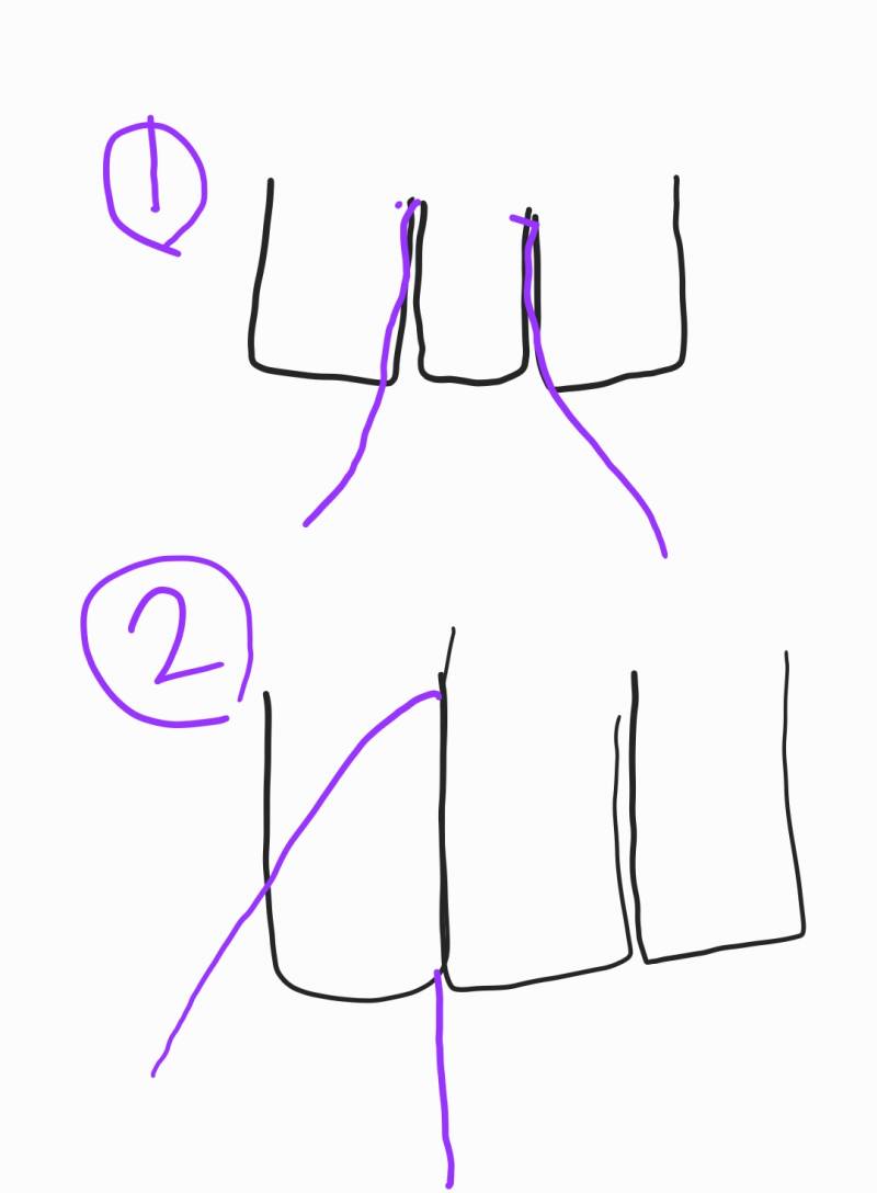 교정유지장치 붙인 익들아 치실 어떻게 써?? | 인스티즈