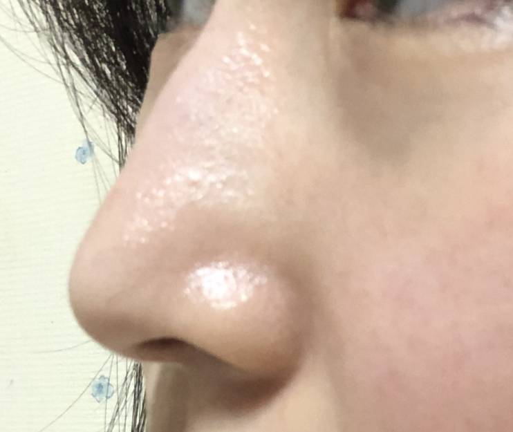 코 매부리 심ㅎㅐ보여? | 인스티즈