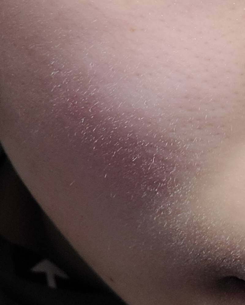 후레시 때문에 솜털 보이네 | 인스티즈