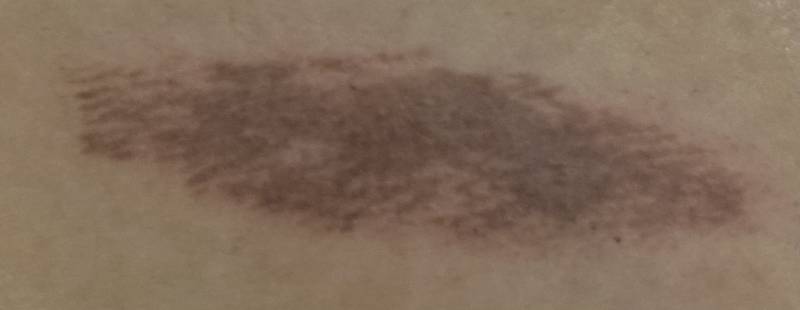 이거 화상 딱지 앉은거야????? | 인스티즈