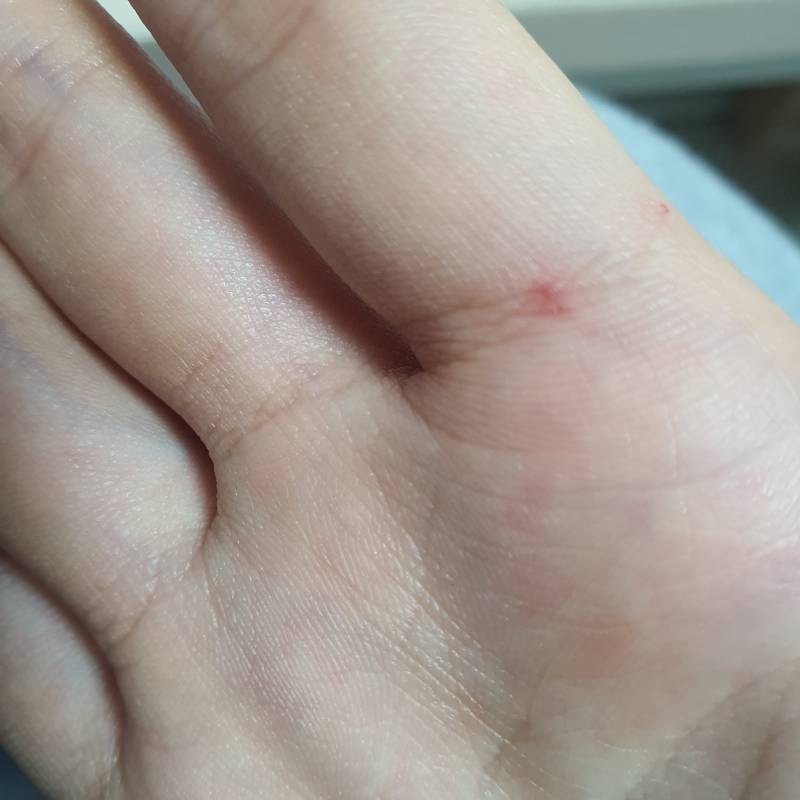나 손 물린건데 누구한테 물린것같아? | 인스티즈