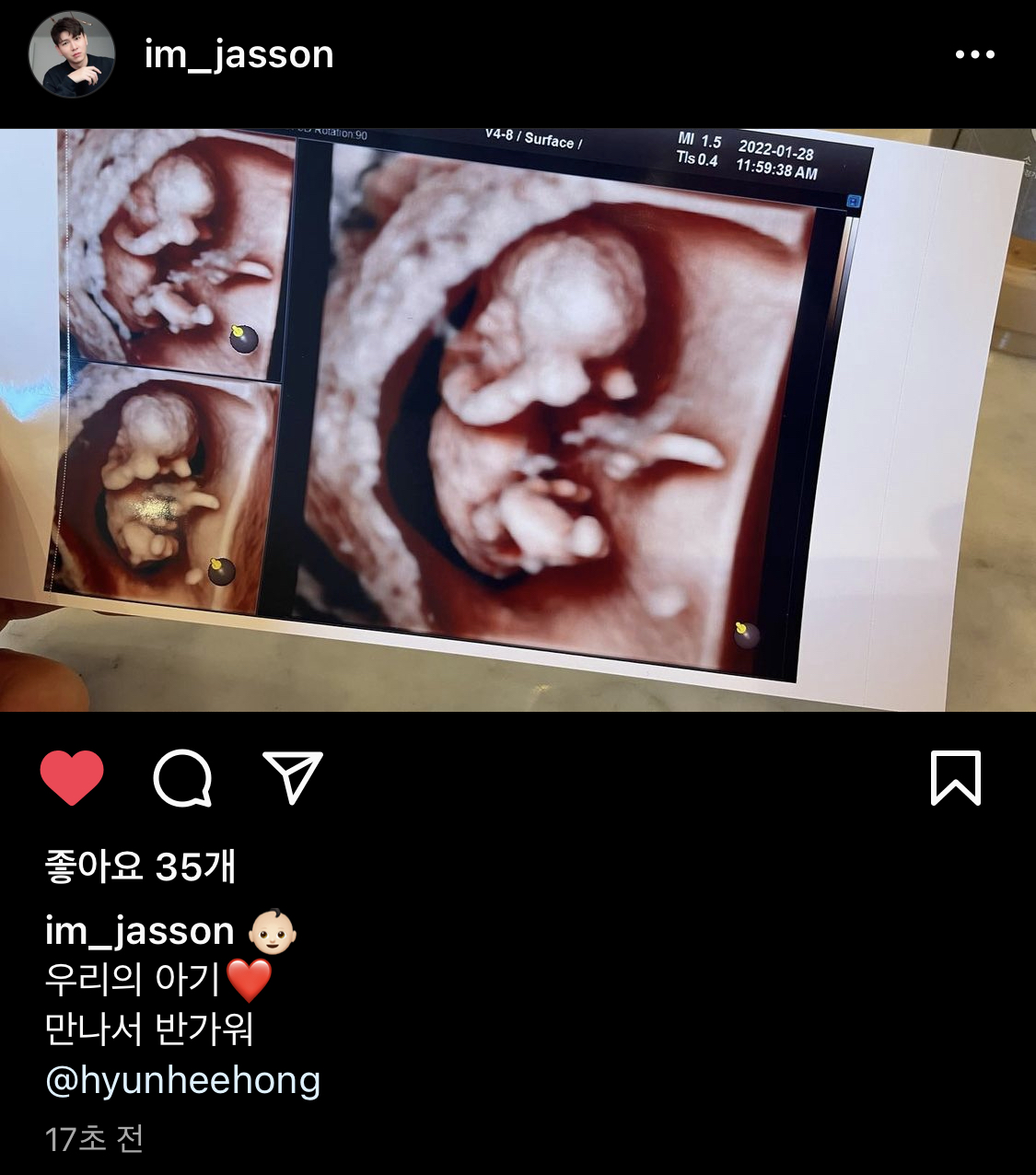 [정보/소식] 홍현희님 임신 하셨다!!!!! | 인스티즈