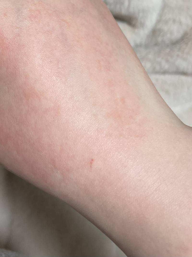 아.. 이거 어케 따가워 | 인스티즈