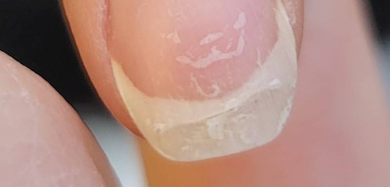 네일하는 익들아 이거 손톱 연장해야 되나...... | 인스티즈