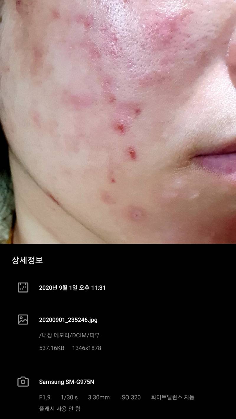 두둥탁🥁피부 근황과 요즘 쓰는 상품(루틴 다 적음) | 인스티즈