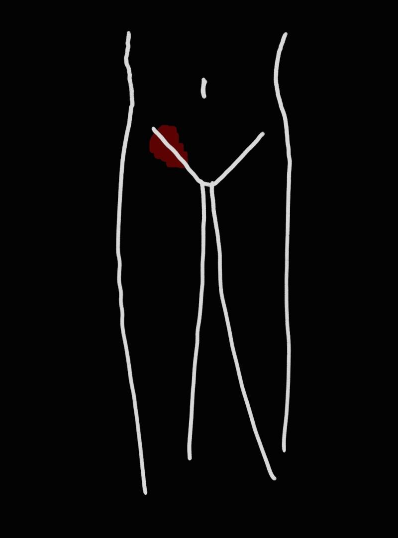 여기.왜 아픈건지 아는 익 ,,, ? | 인스티즈