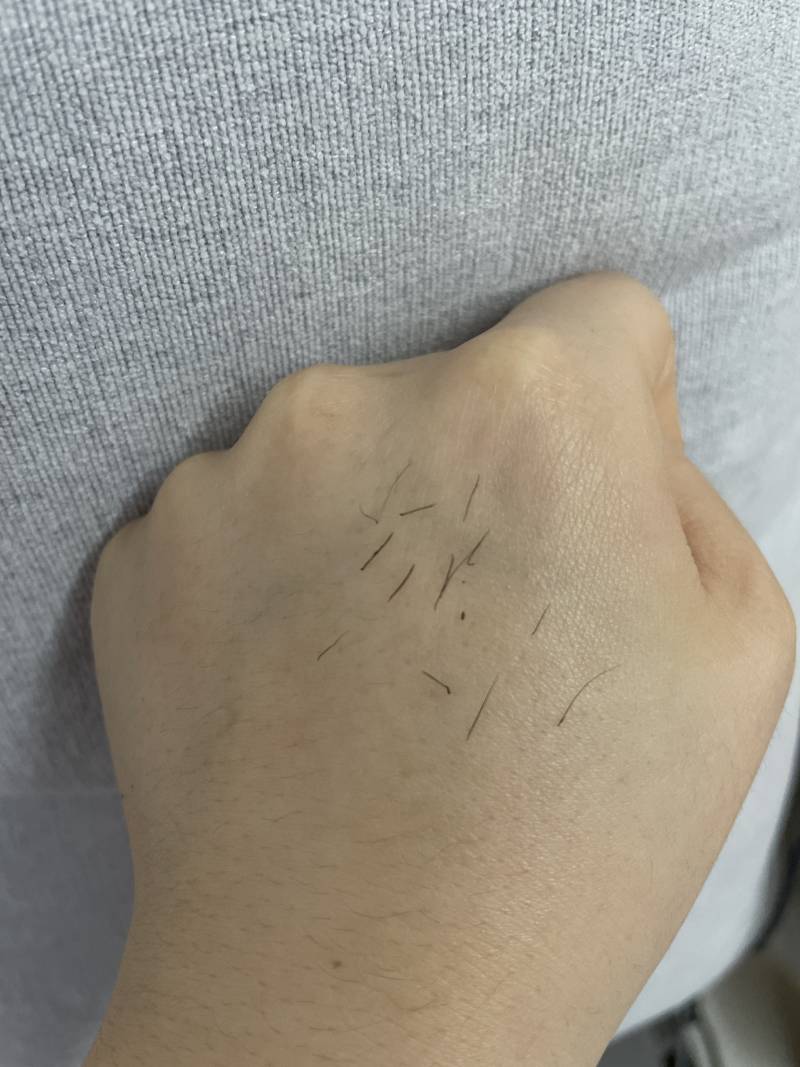 어디서 뽑은 털이게~? | 인스티즈