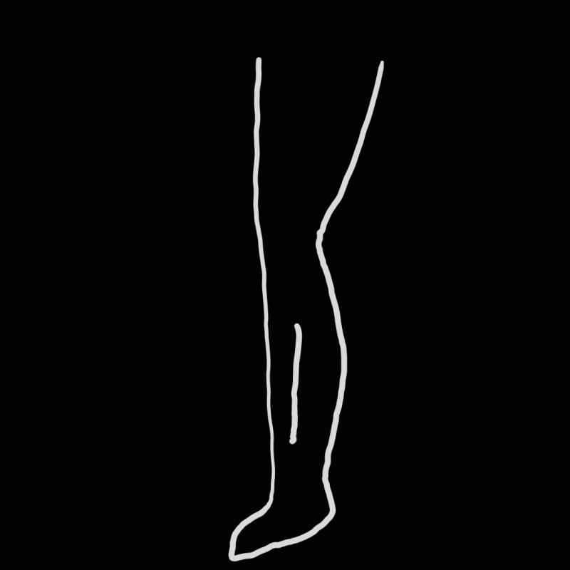 종아리에 이렇게 선 생기는 이유가 뭐야? | 인스티즈