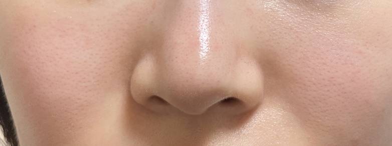 모공 잘보이는 거 맞지ㅠㅠ | 인스티즈