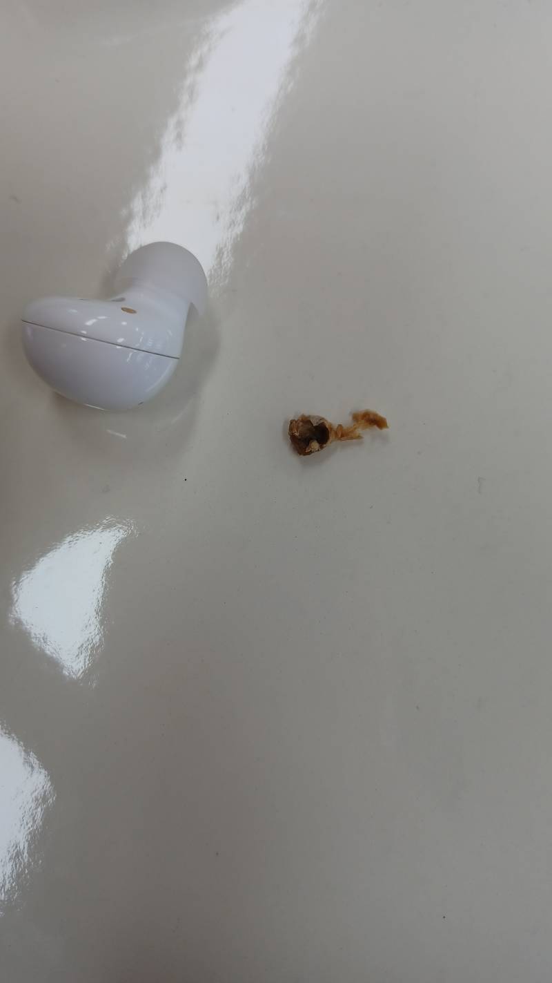 ㅎㅇㅈㅇ귀지 왕건이 나옴 | 인스티즈