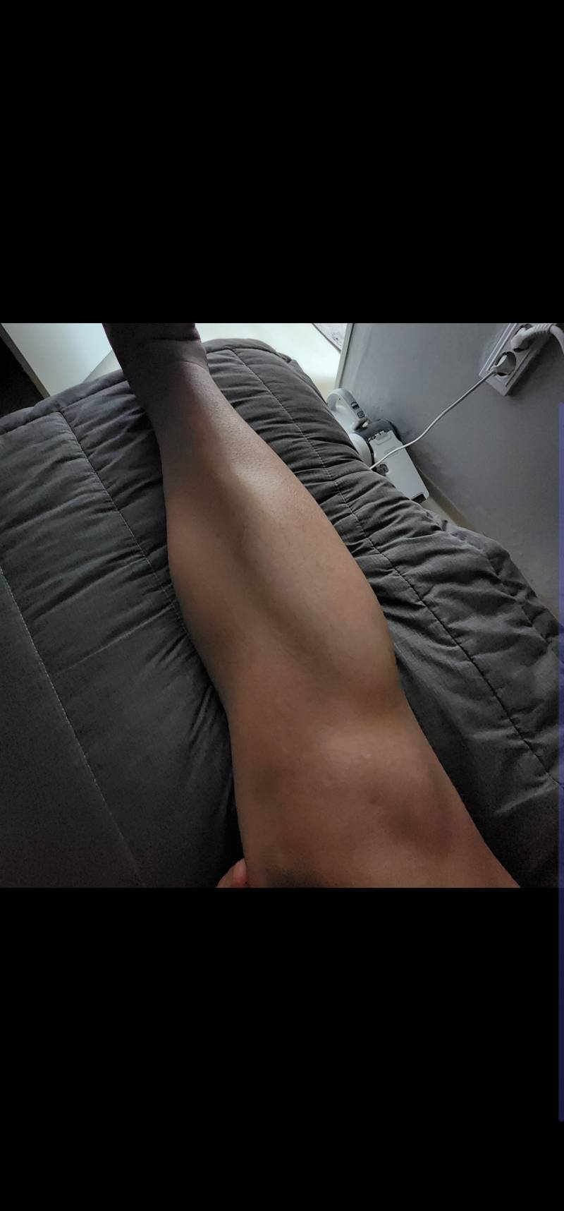 진정한 하체발달형 이거 어떻게 빼냐 ㅠㅠㅠㅜ | 인스티즈