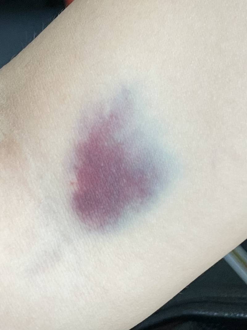 간호사 익들아 이거 괜찮은거야...? | 인스티즈